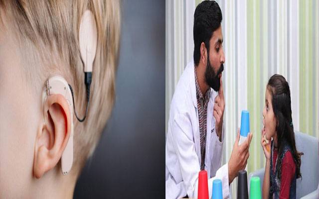 گونگے بہرے بچوں کیلئے کوکلیئر امپلانٹ کی سہولت کا آغاز