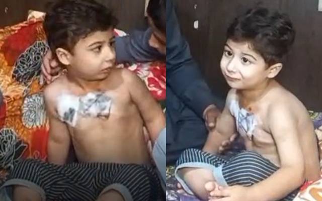 لاہور: 4 سالہ معصوم بچے پر پالتو کتے کا حملہ