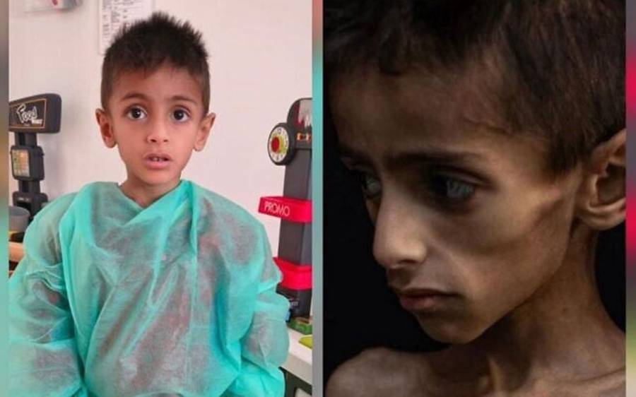 Gaza food crisis, Hmanitarian aid, COGAT, Viral image of emaciated 5-year-old