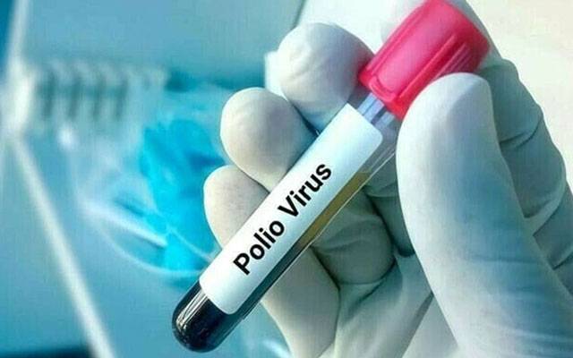 پشاور: پولیو کا  ایک اورکیس سامنے آگیا