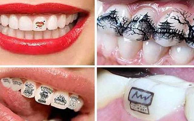 جلد کے ٹیٹوز سے اکتا کر چینی نوجوان دانتوں پر ٹیٹوز بنوانے لگے