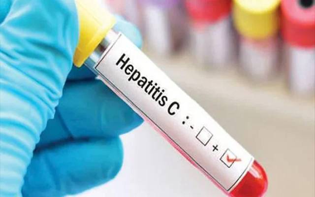 ہیپاٹائٹس سی کے خاتمے کےلیے بڑا اقدام: پنجاب اور سندھ میں مفت اسکریننگ کیمپ