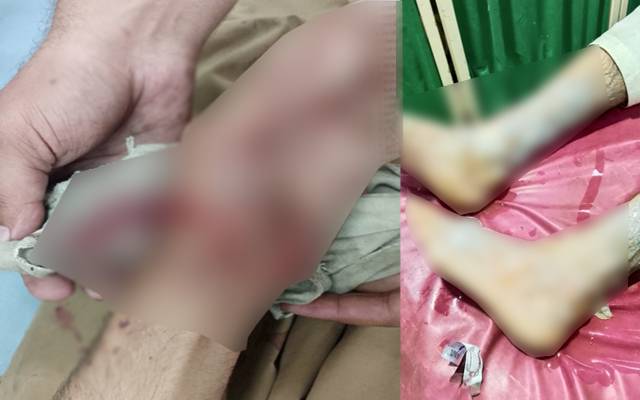  گرین ٹاؤن: ملزم نے دکاندار کے بیٹوں پر گرم دودھ پھینک، چاقو کے وار
