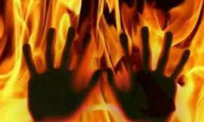  گھریلو جھگڑا: شوہر نے تیل چھڑک کر بیوی کو جلا دیا