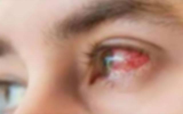 لاہور میں تین روزہ سب سے بڑی امراض چشم کی سالانہ کانفرنس منعقد ہونے کو تیار!