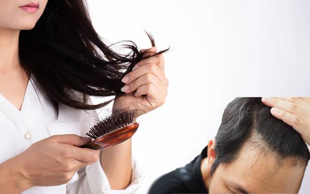 سردیوں میں بال زیادہ کیوں گرتے ہیں؟ کیسے بچائیں؟ 