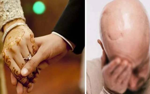 گھنے بالوں کا جھانسہ؛ شوہر گنجا نکلا؛بیوی نے مقدمہ درج کروا دیا 