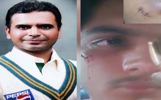 سابق انٹرنیشنل کرکٹر کے بیٹے پر اوباش نوجوانوں کا تشدد