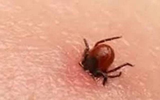 کانگو وائرس کے خطرات بڑھنے کا خدشہ