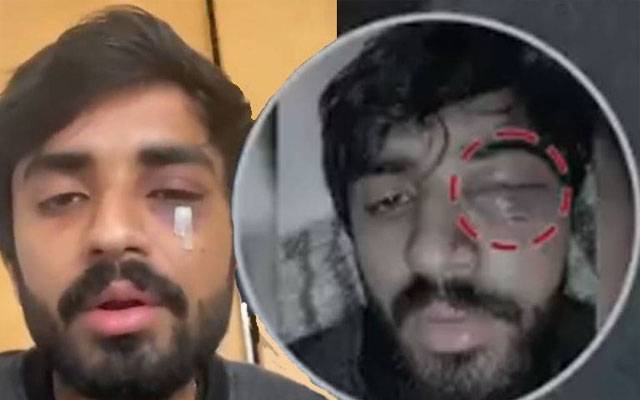 سکاٹ لینڈ میں پاکستانی طالب علم مصدق اسماعیل پر حملے کے واقعہ کی تفصیلات سامنے آ گئیں