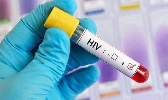 HIV کیسز میں اضافہ،فجی میں ایمرجنسی کااعلان