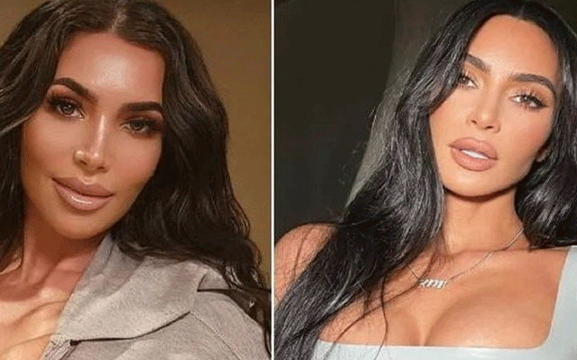  کم کارڈیشین کی ہمشکل پلاسٹک سرجری کے چند روز بعد چل بسیں