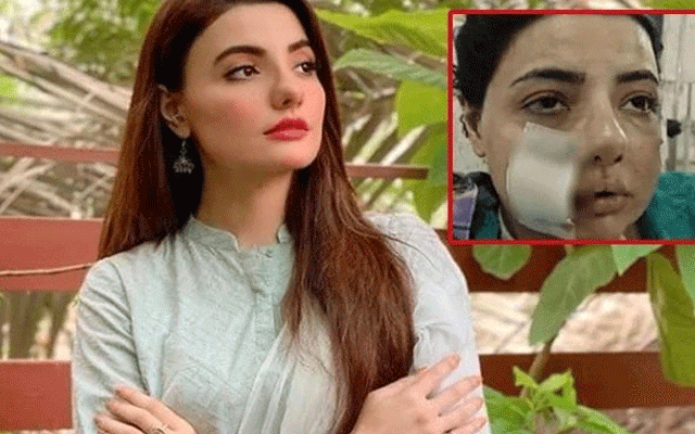 ماڈل زینب جمیل پر  حملے کی تفتیش پیشرفت میں زینب کے شوہر جمیل کا پاسپورٹ اور شناختی کارڈ بلاک کردیا گیا۔