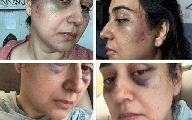  لاہور  کی مقامی عدالت نے اینکرپرسن عائشہ جہانزیب کو گھریلو  تشدد کا نشانہ بنانے کے کیس میں شوہرحارث کا 2 دن کا جسمانی ریمانڈ منظور کرلیا۔